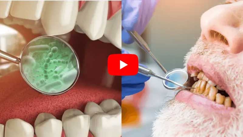 Dental Health